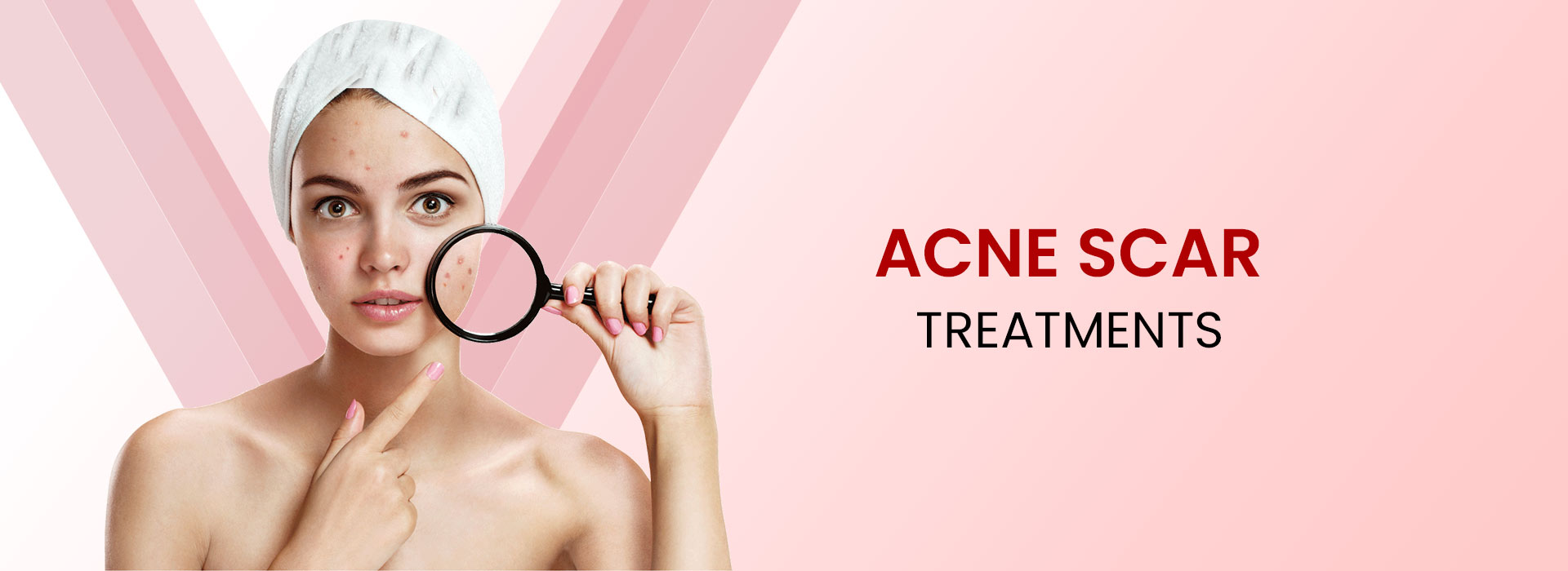 Acne Scar Treatment